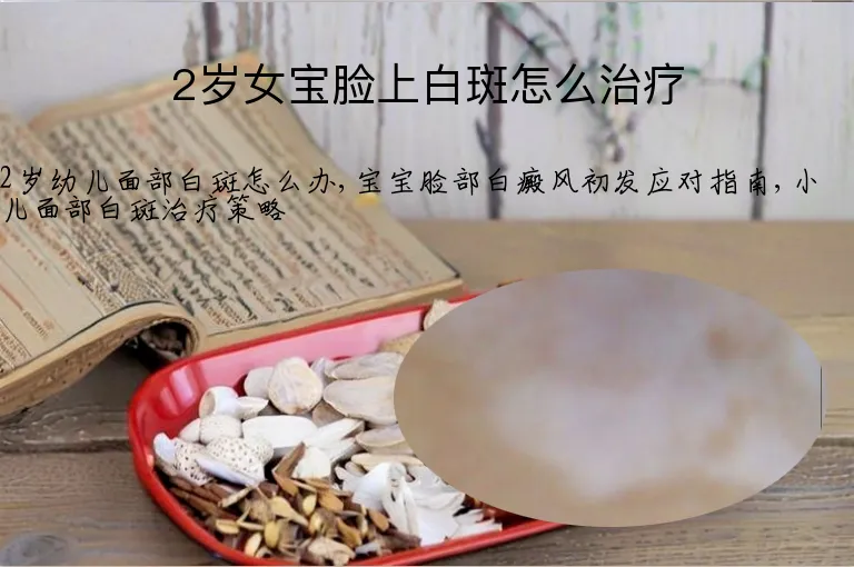 2岁女宝脸上白斑怎么治疗