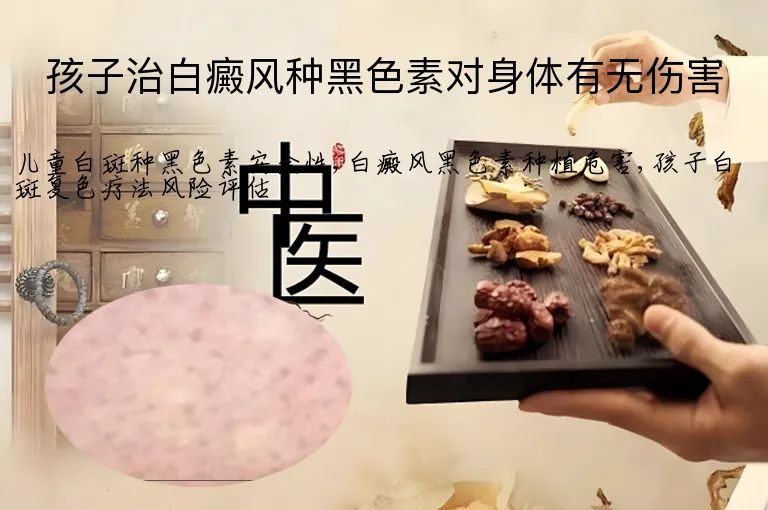 孩子治白癜风种黑色素对身体有无伤害