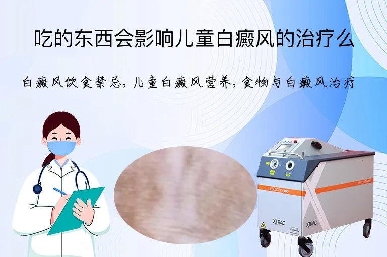 吃的东西会影响儿童白癜风的治疗么