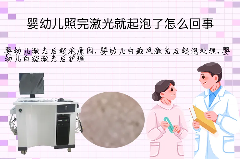 婴幼儿照完激光就起泡了怎么回事