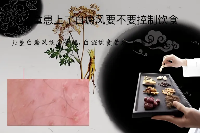 儿童患上了白癜风要不要控制饮食