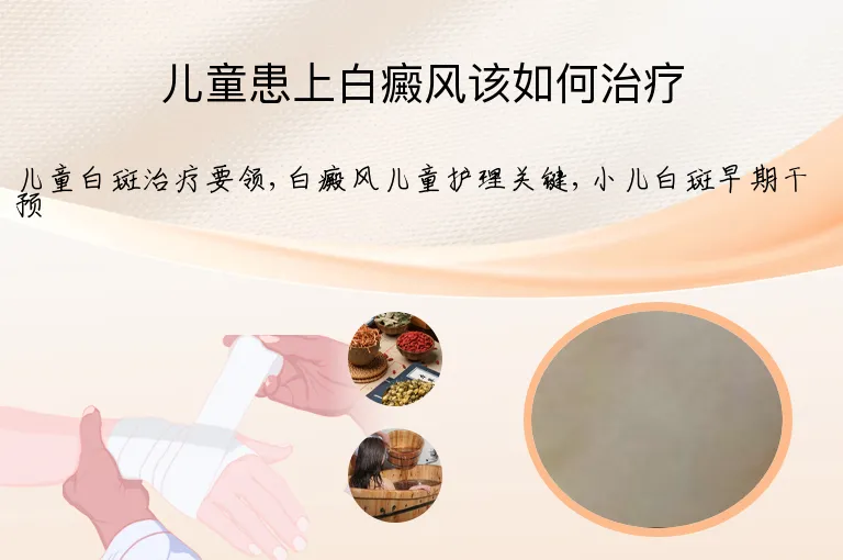 儿童患上白癜风该如何治疗
