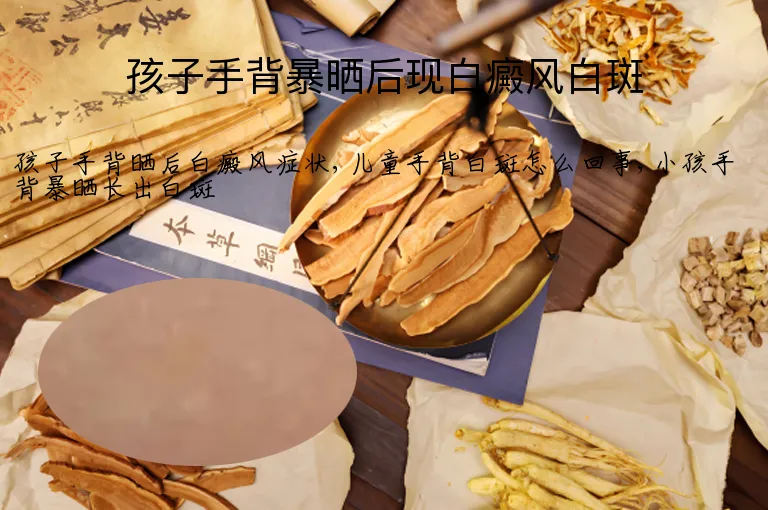 孩子手背暴晒后现白癜风白斑