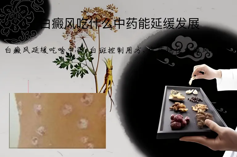 白癜风吃什么中药能延缓发展