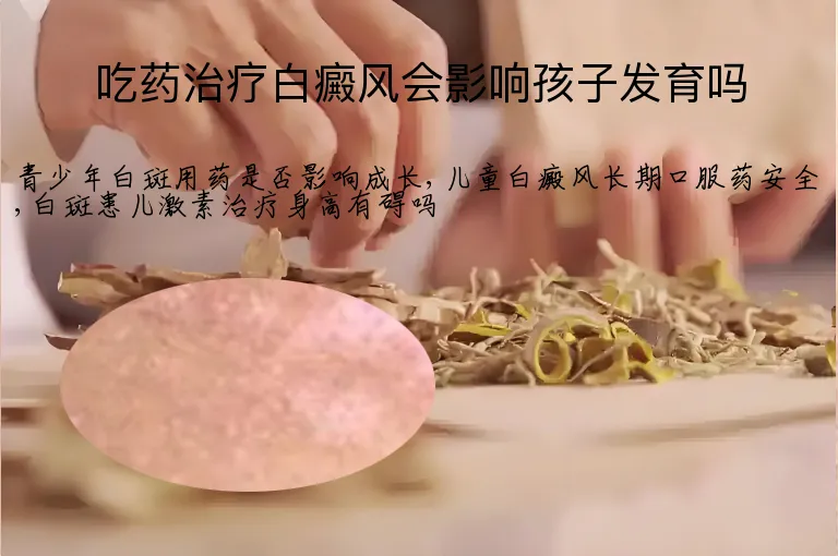 吃药治疗白癜风会影响孩子发育吗