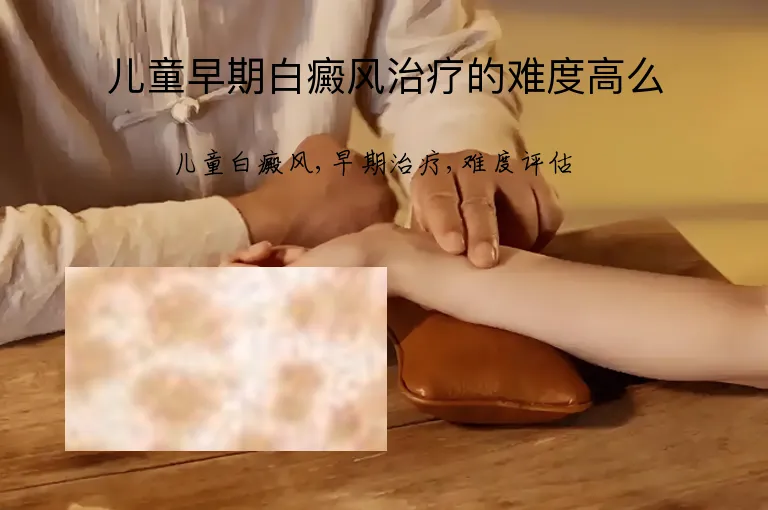 儿童早期白癜风治疗的难度高么