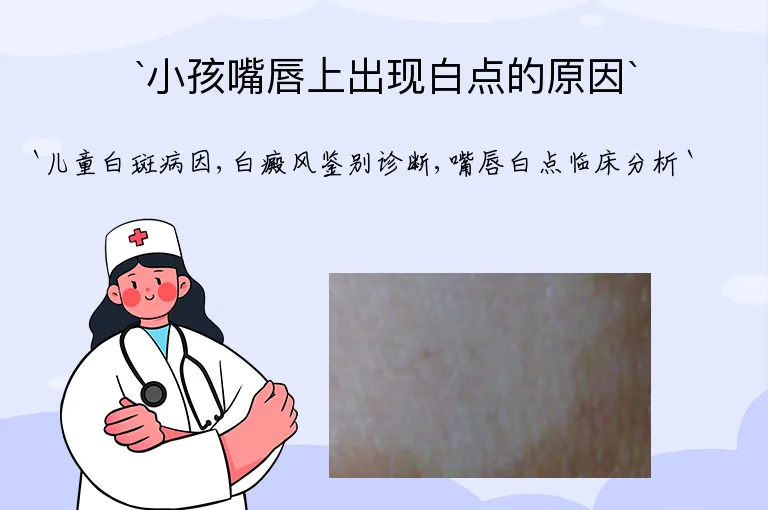 小孩嘴唇上出现白点的原因