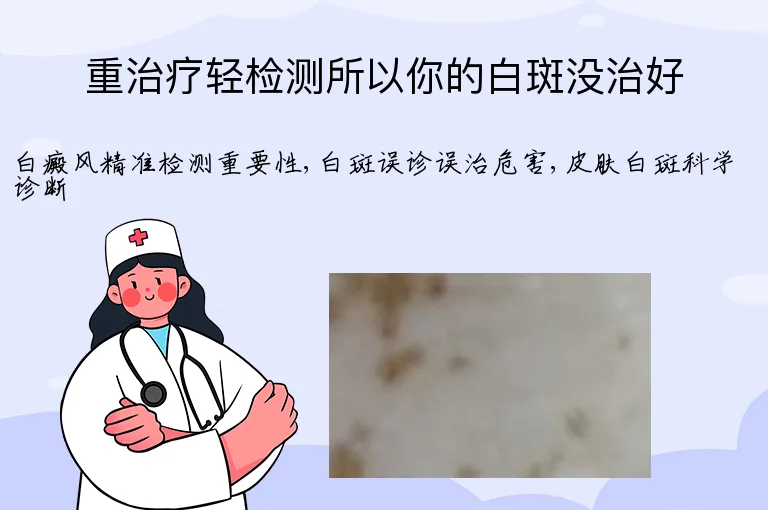 重治疗轻检测所以你的白斑没治好