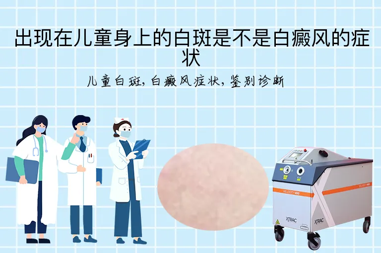 出现在儿童身上的白斑是不是白癜风的症状