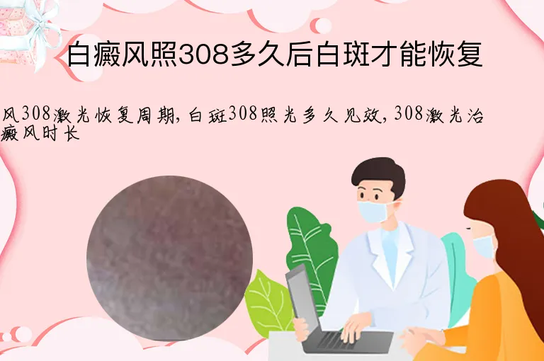 白癜风照308多久后白斑才能恢复