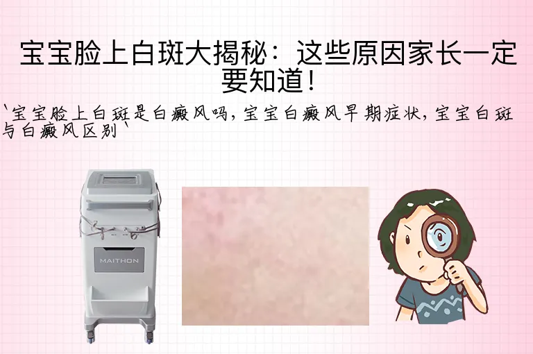 宝宝脸上白斑大揭秘：这些原因家长一定要知道！