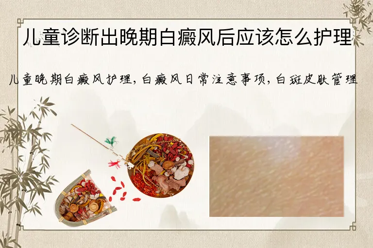 儿童诊断出晚期白癜风后应该怎么护理