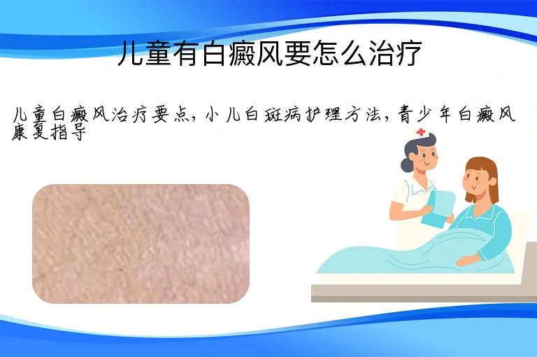 儿童有白癜风要怎么治疗