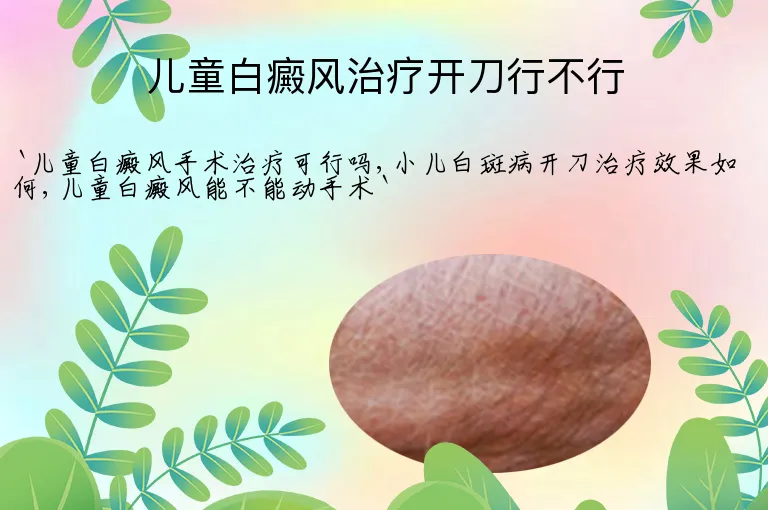儿童白癜风治疗开刀行不行