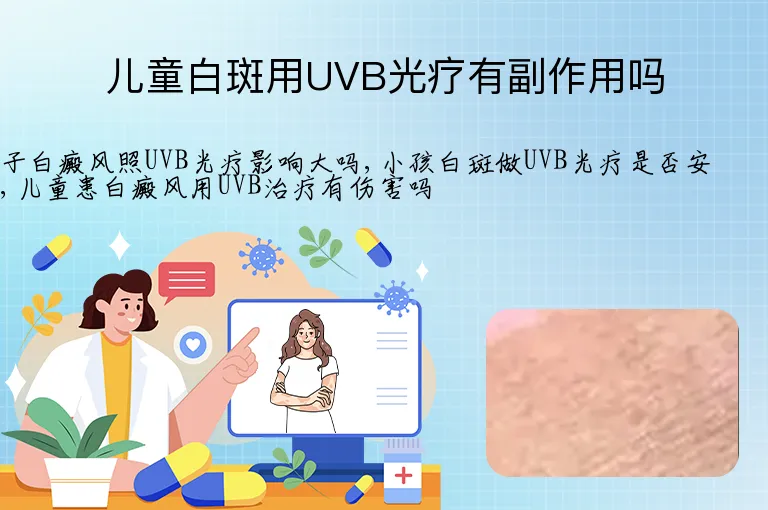 儿童白斑用UVB光疗有副作用吗