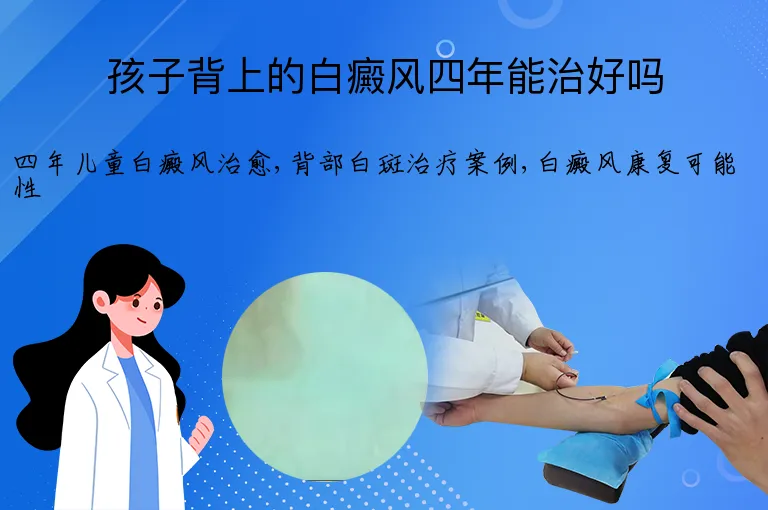 孩子背上的白癜风四年能治好吗