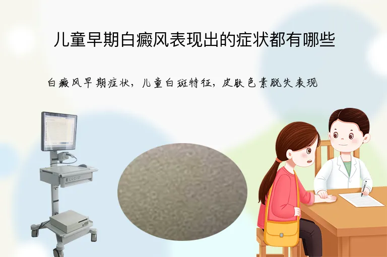 儿童早期白癜风表现出的症状都有哪些