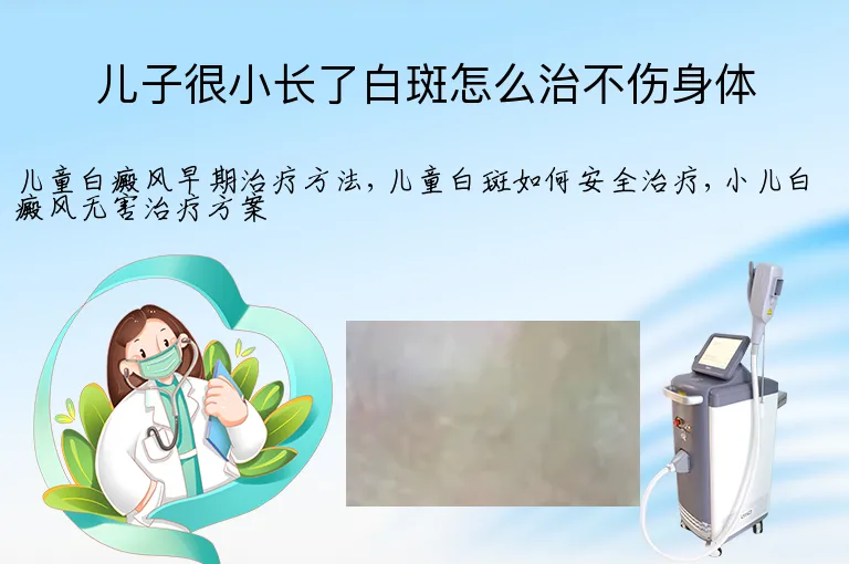 儿子很小长了白斑怎么治不伤身体