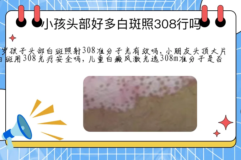 小孩头部好多白斑照308行吗