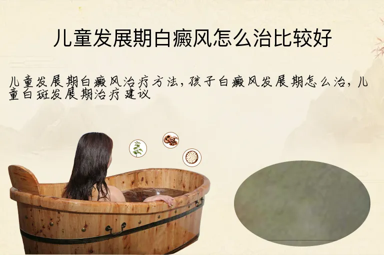儿童发展期白癜风怎么治比较好