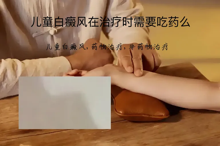 儿童白癜风在治疗时需要吃药么