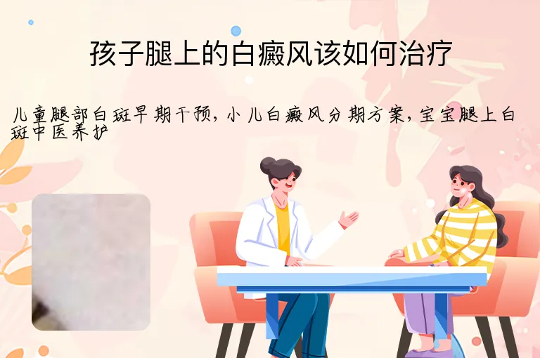 孩子腿上的白癜风该如何治疗