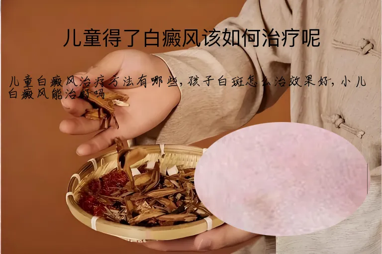 儿童得了白癜风该如何治疗呢