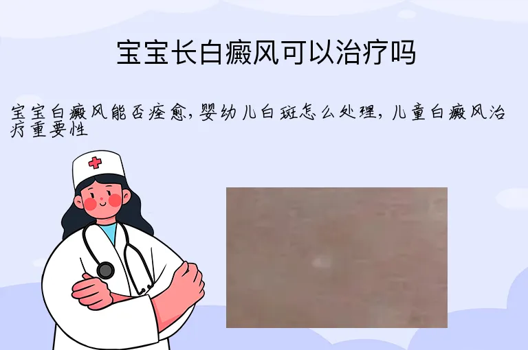 宝宝长白癜风可以治疗吗