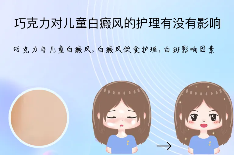 巧克力对儿童白癜风的护理有没有影响