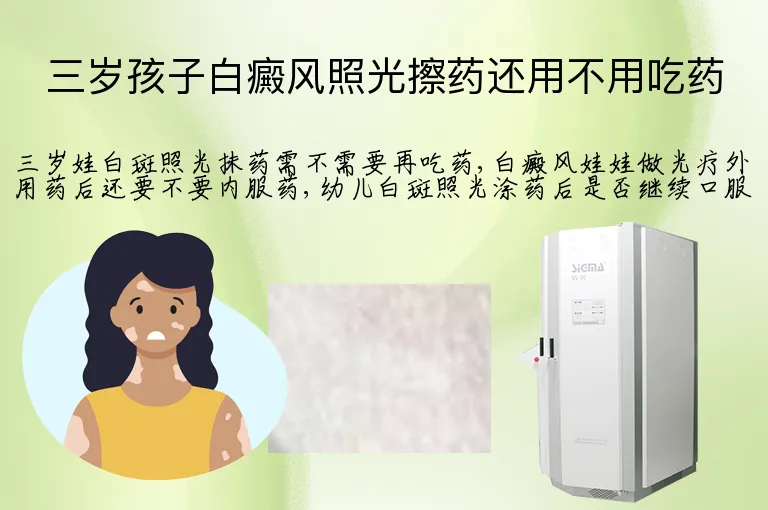 三岁孩子白癜风照光擦药还用不用吃药