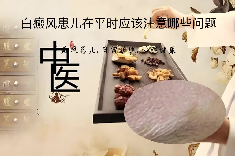 白癜风患儿在平时应该注意哪些问题