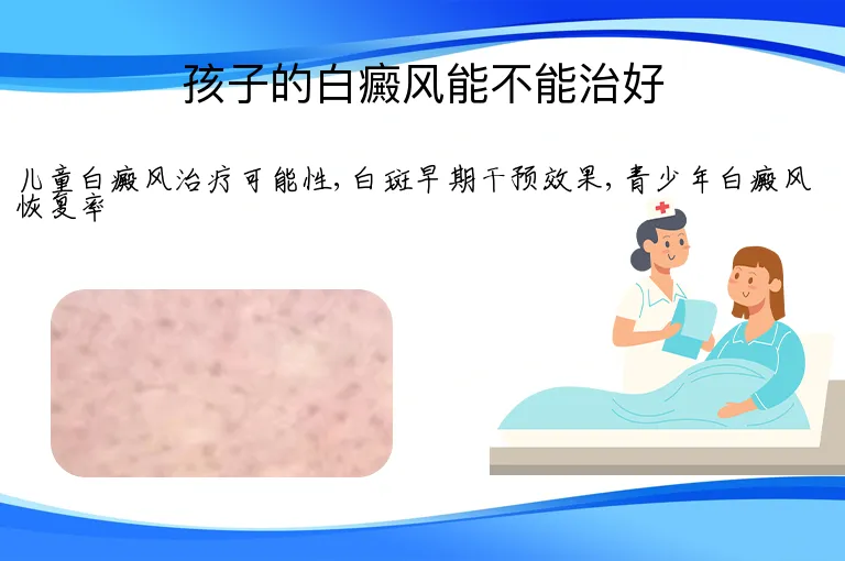 孩子的白癜风能不能治好