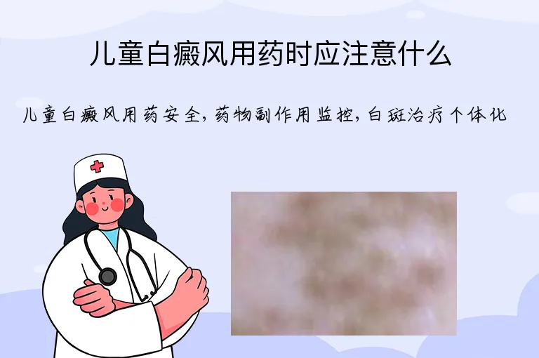 儿童白癜风用药时应注意什么
