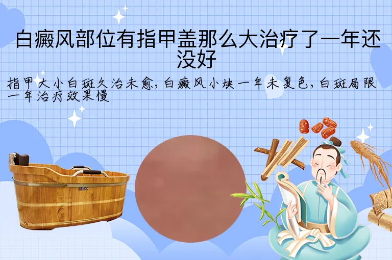 白癜风部位有指甲盖那么大治疗了一年还没好