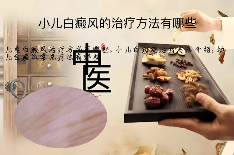 小儿白癜风的治疗方法有哪些