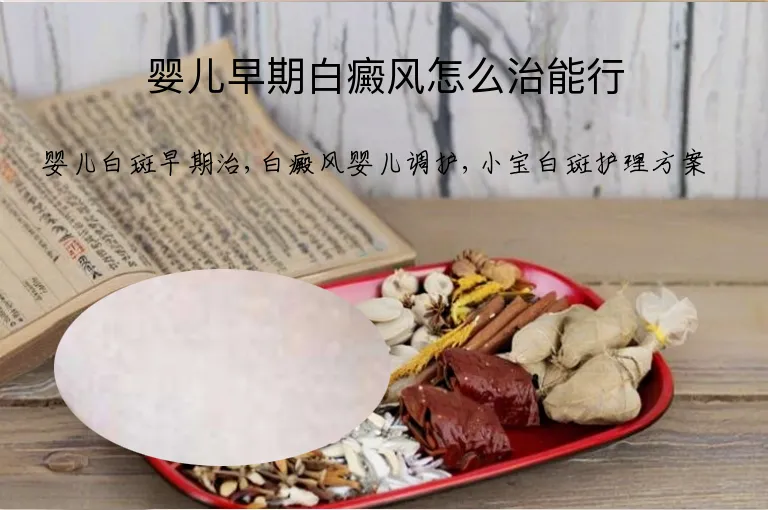 婴儿早期白癜风怎么治能行