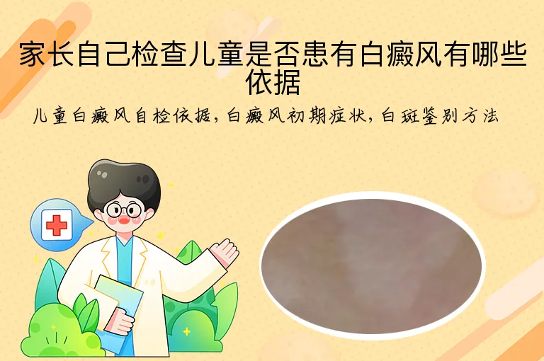 家长自己检查儿童是否患有白癜风有哪些依据