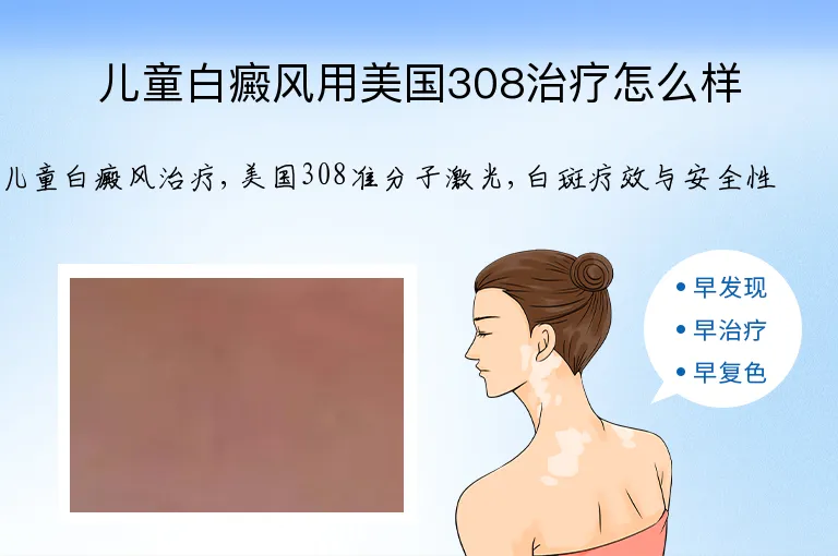 儿童白癜风用美国308治疗怎么样