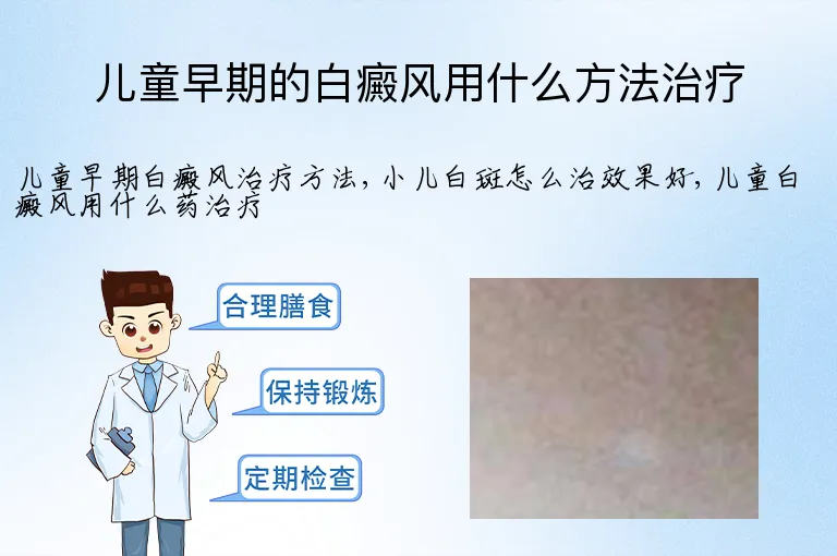 儿童早期的白癜风用什么方法治疗