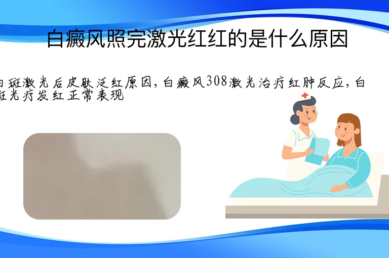 白癜风照完激光红红的是什么原因