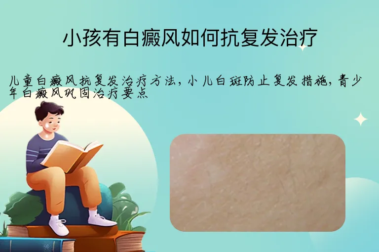 小孩有白癜风如何抗复发治疗