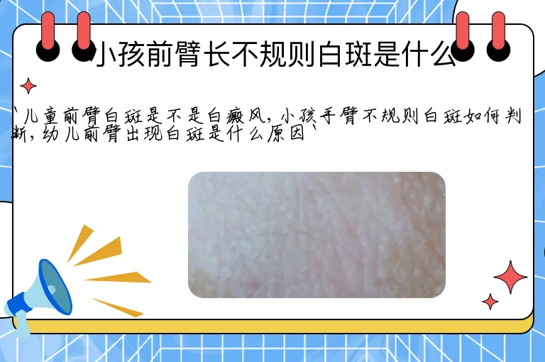 小孩前臂长不规则白斑是什么