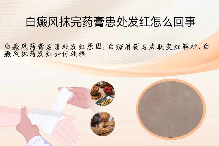 白癜风抹完药膏患处发红怎么回事