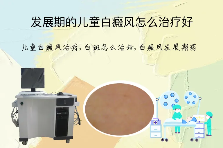 发展期的儿童白癜风怎么治疗好