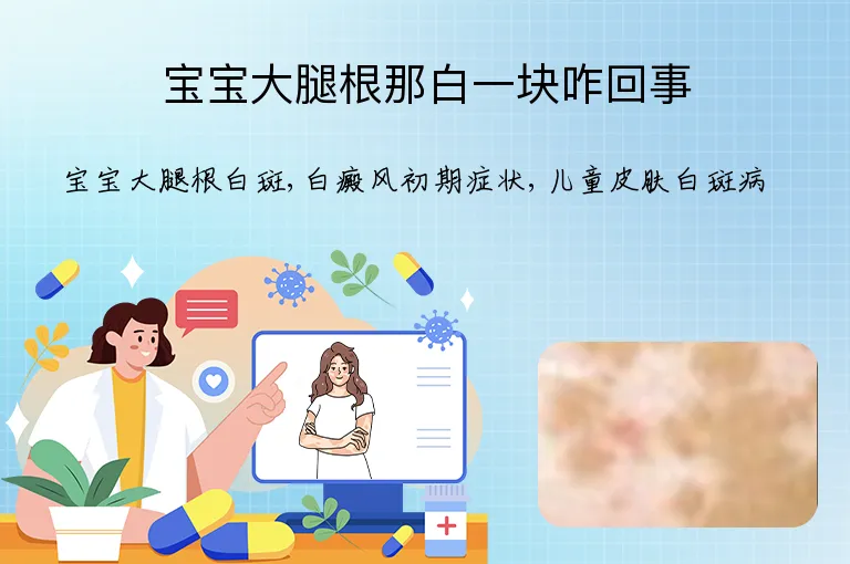 宝宝大腿根那白一块咋回事