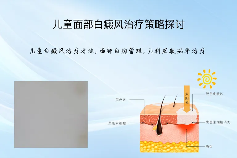 儿童面部白癜风治疗策略探讨