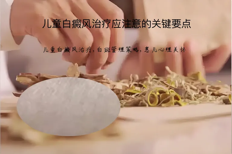 儿童白癜风治疗应注意的关键要点