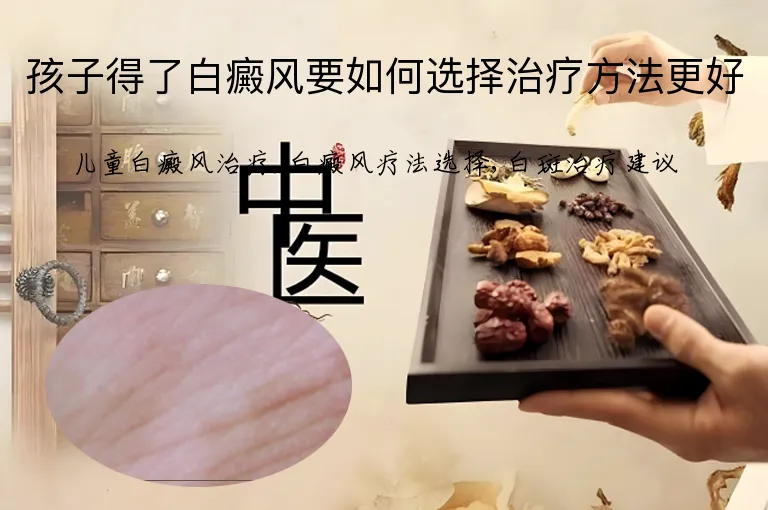 孩子得了白癜风要如何选择治疗方法更好