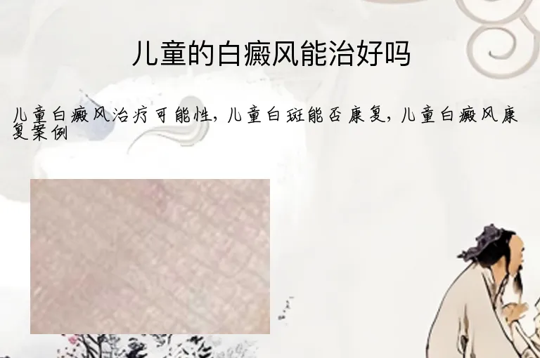 儿童的白癜风能治好吗