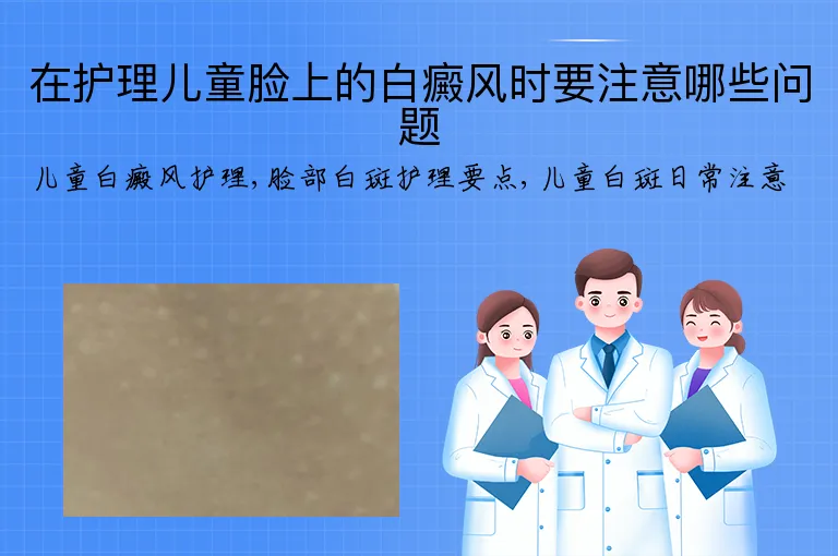 在护理儿童脸上的白癜风时要注意哪些问题